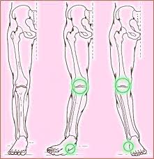A csontvelőgyulladás tünetei és kezelése - HáziPatika Hogyan lehet kezelni a lábfej lábszárcsontját