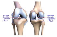 a térd elülső keresztszalagjának sérüléseinek kezelése