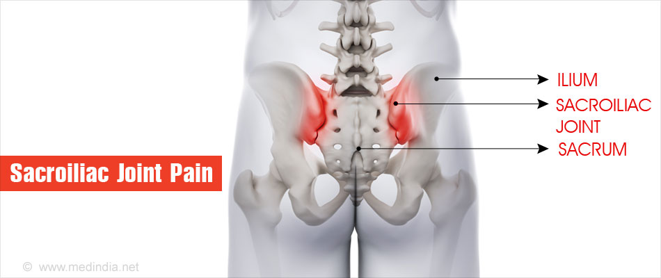 deformáló osteoarthritis a 2. fokú kezelés