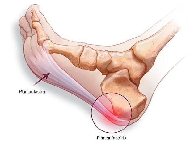 a láb alsó lábának ízületi kezelése